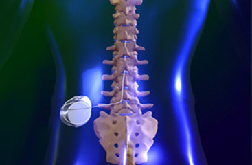 intrathecal-drug-delivery-placement intrathecal-drug-delivery-placement