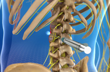 lumbar-sympathetic-block