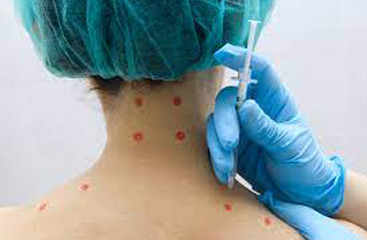 trigger-point trigger-point